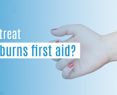 How to Treat Minor Burns First Aid